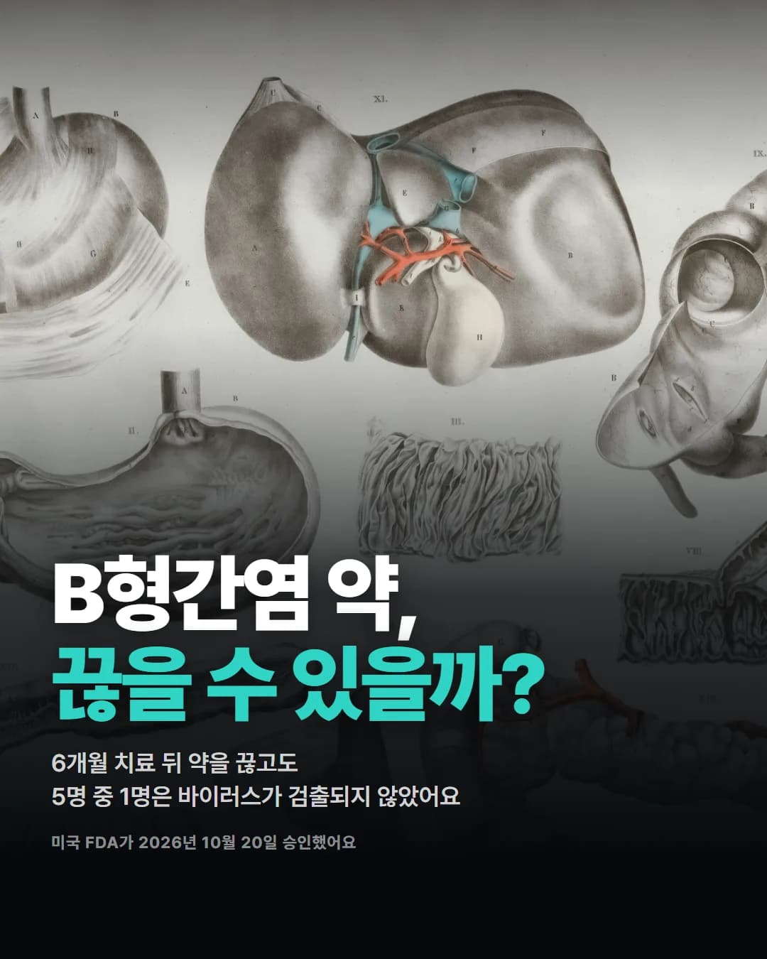 B형간염 약,
끊을 수 있을까?
6개월 치료 뒤 약을 끊고도
5명 중 1명은 바이러스가 검출되지 않았어요
미국 FDA가 2026년 10월 20일 승인했어요